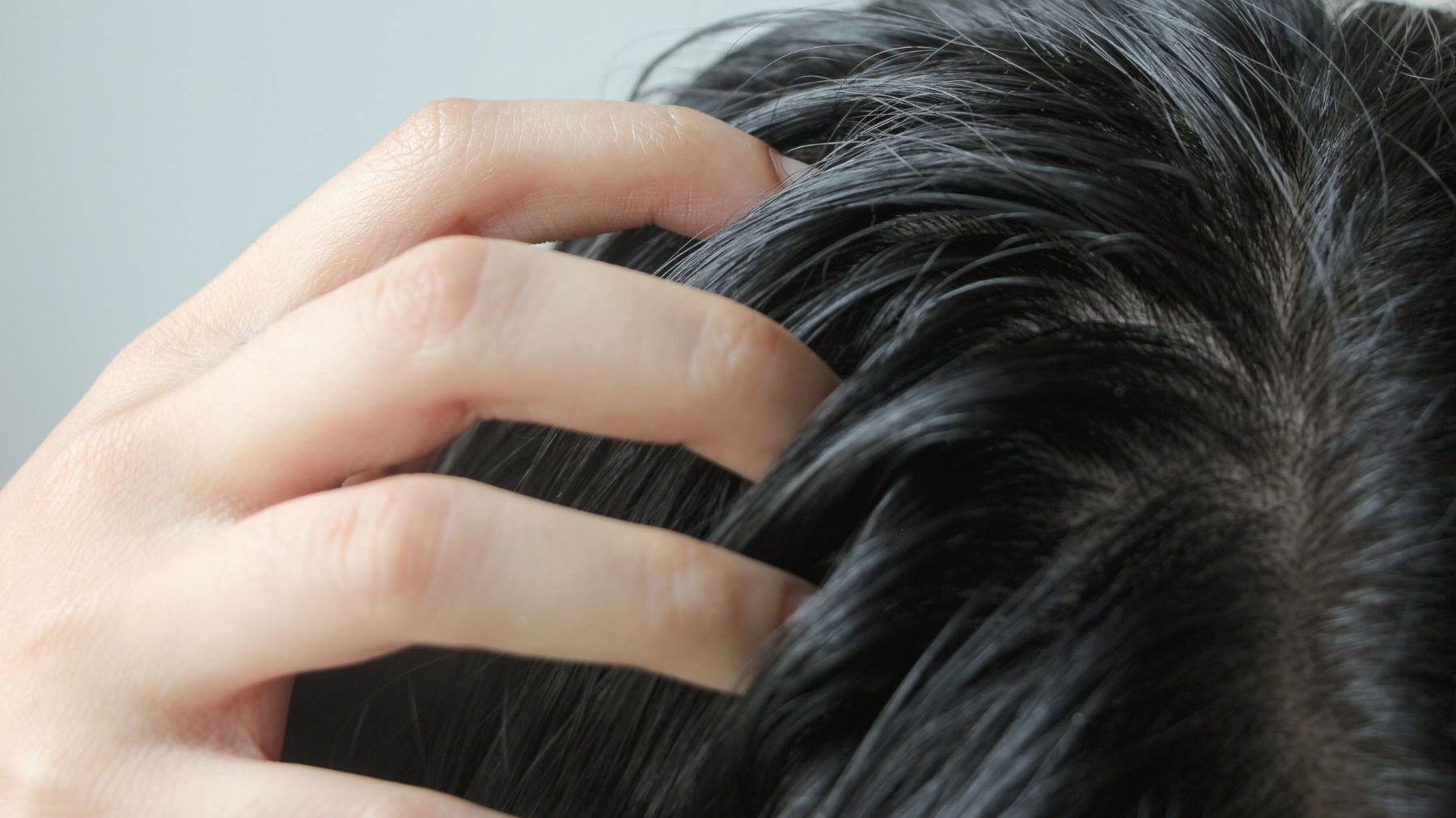 Why Is My Scalp Oily? The Science of Summer Sebum