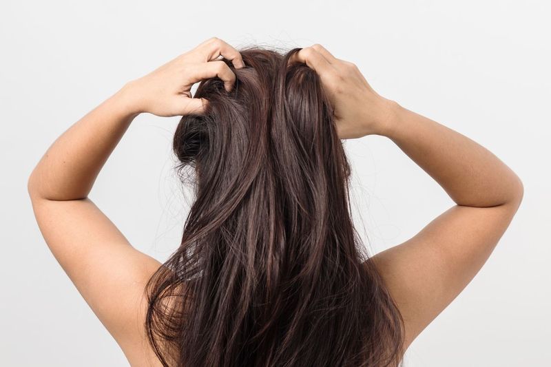 Dandruff vs Dry Scalp