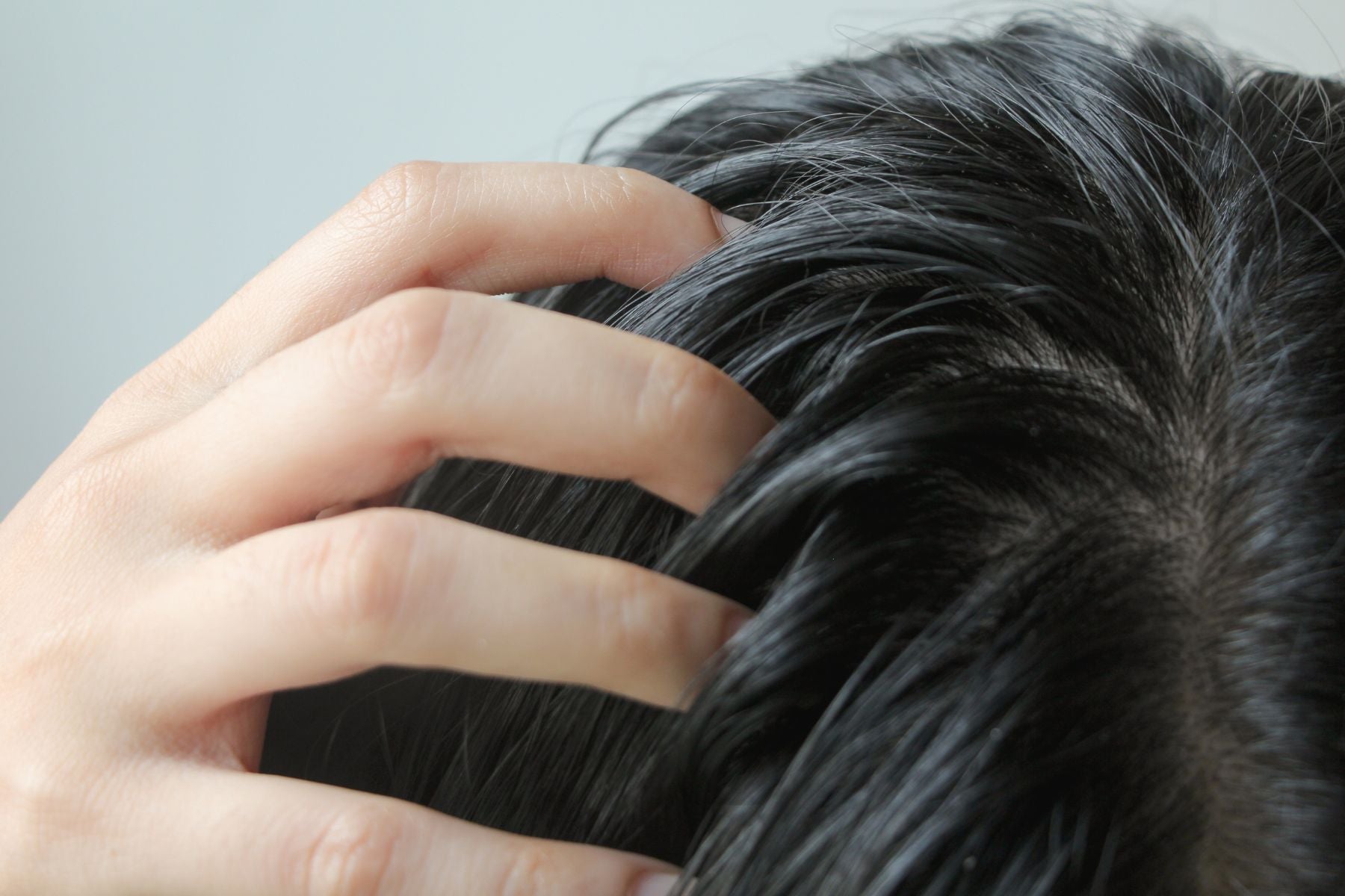 Why Is My Scalp Oily? The Science of Summer Sebum